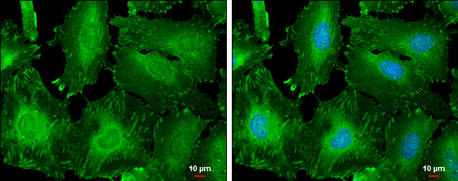 Zyxin Antibody in Immunocytochemistry (ICC/IF)