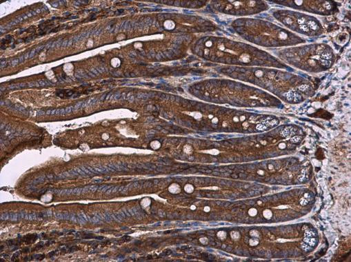 RAB7A Antibody in Immunohistochemistry (Paraffin) (IHC (P))