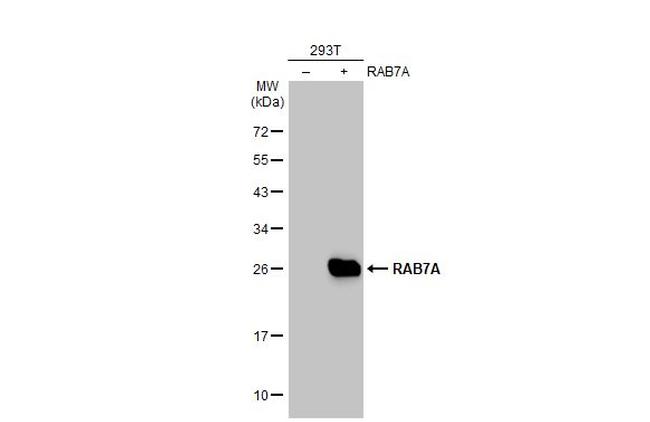 RAB7A Antibody in Western Blot (WB)