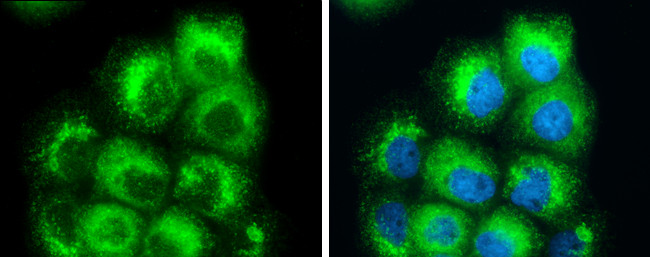 RAB7A Antibody in Immunocytochemistry (ICC/IF)