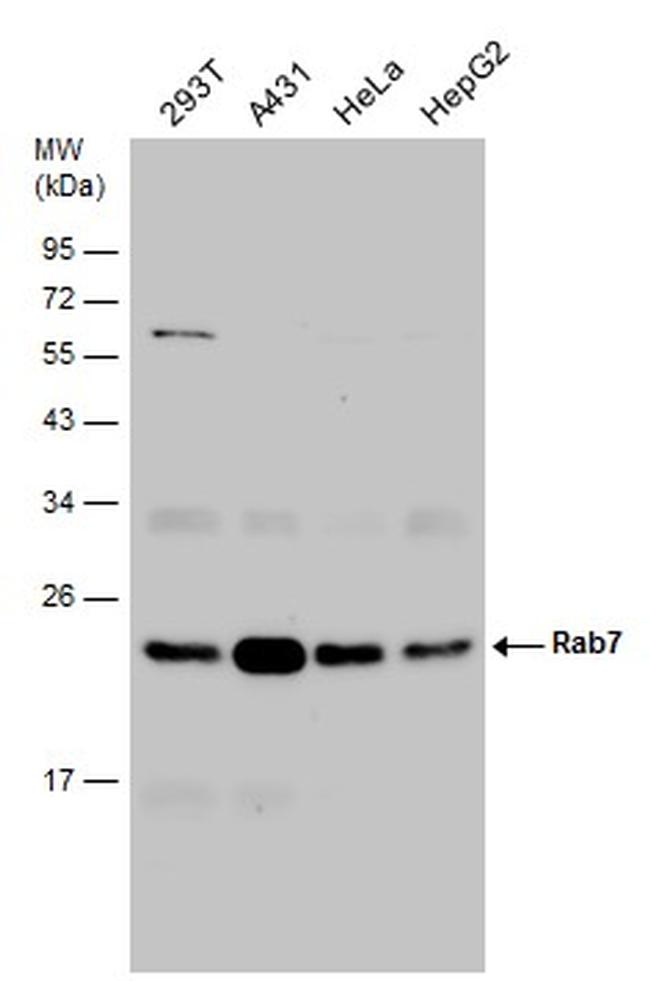 RAB7A Antibody in Western Blot (WB)