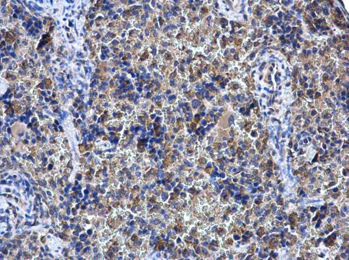 SHOC2 Antibody in Immunohistochemistry (Paraffin) (IHC (P))