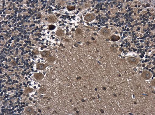 AXIN2 Antibody in Immunohistochemistry (Paraffin) (IHC (P))