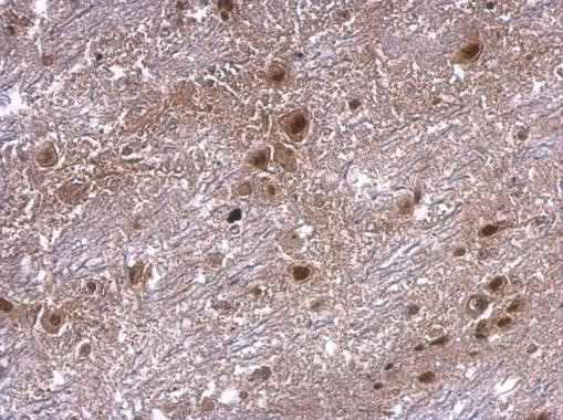 AXIN2 Antibody in Immunohistochemistry (Paraffin) (IHC (P))