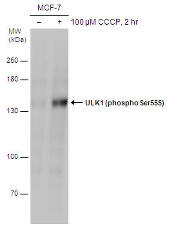 Phospho-ULK1 (Ser555) Antibody in Western Blot (WB)