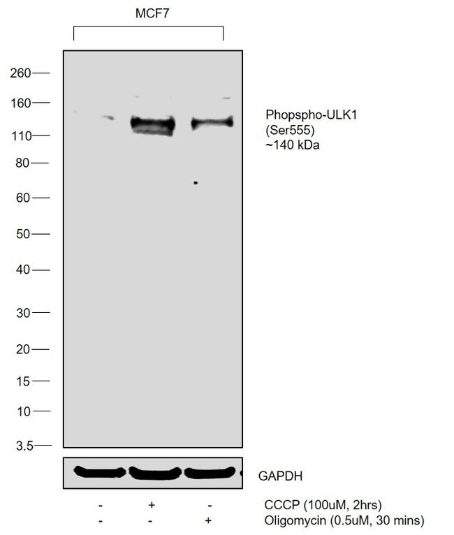 Phospho-ULK1 (Ser555) Antibody in Western Blot (WB)