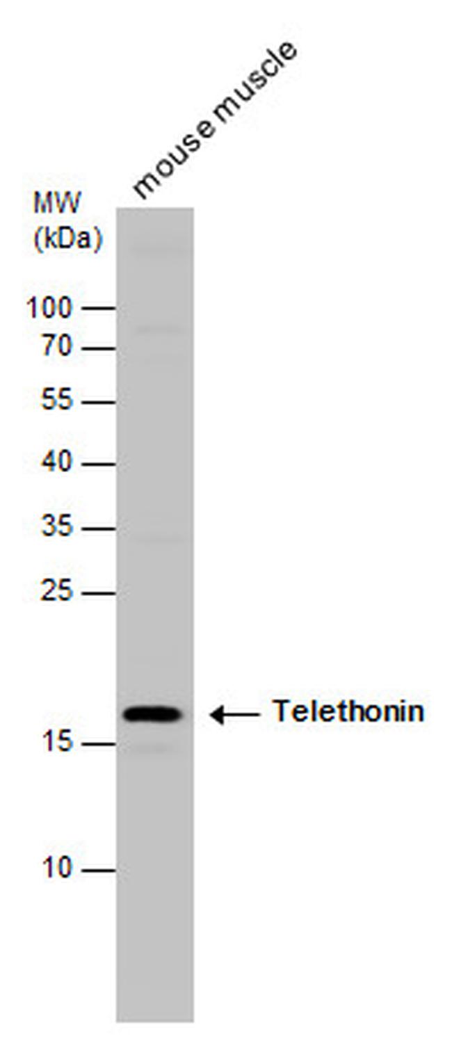 TCAP Antibody in Western Blot (WB)