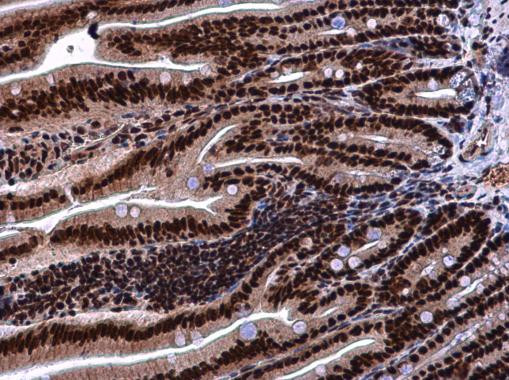 KHSRP Antibody in Immunohistochemistry (Paraffin) (IHC (P))