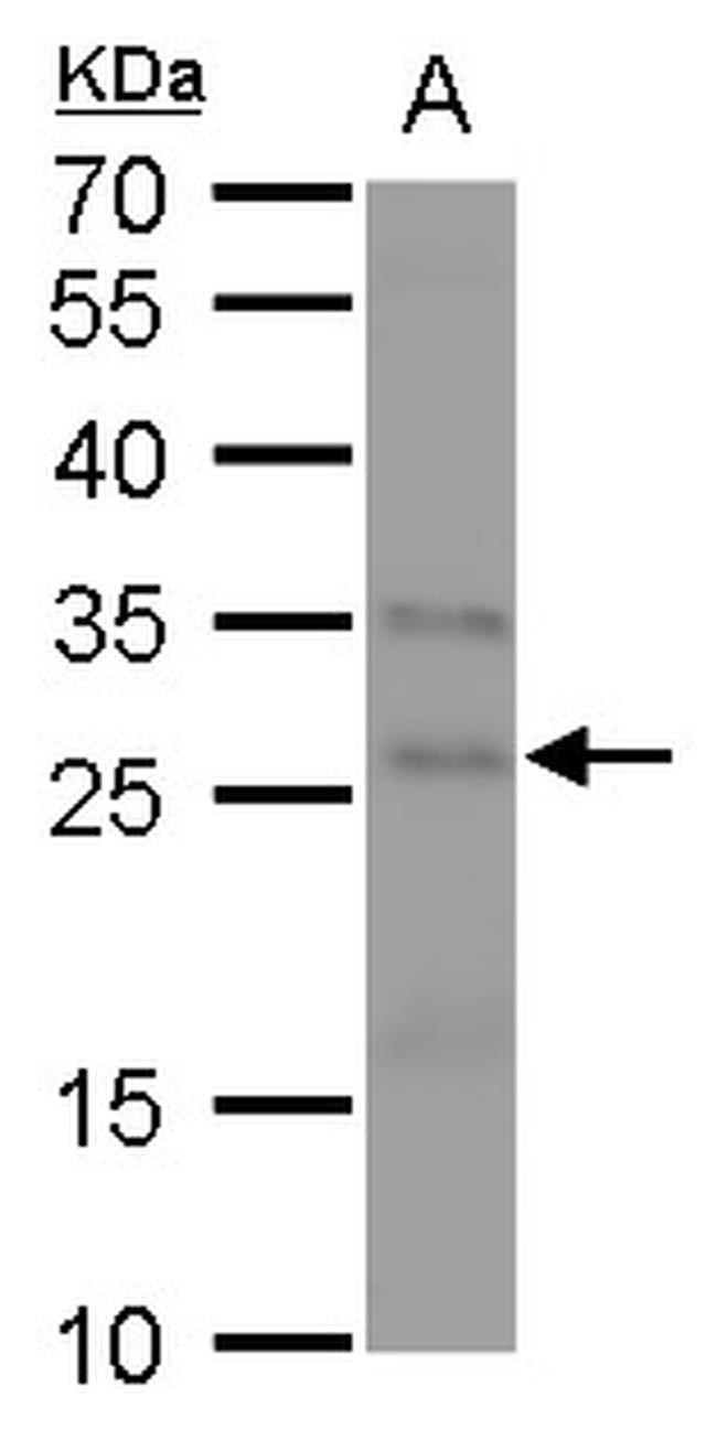 FGF18 Antibody in Western Blot (WB)