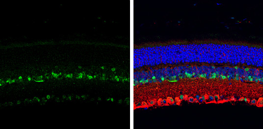 PER2 Antibody in Immunohistochemistry (Paraffin) (IHC (P))