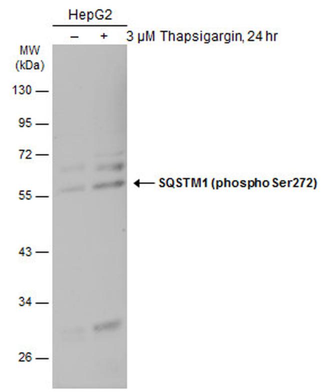 Phospho-SQSTM1 (Ser272) Antibody in Western Blot (WB)