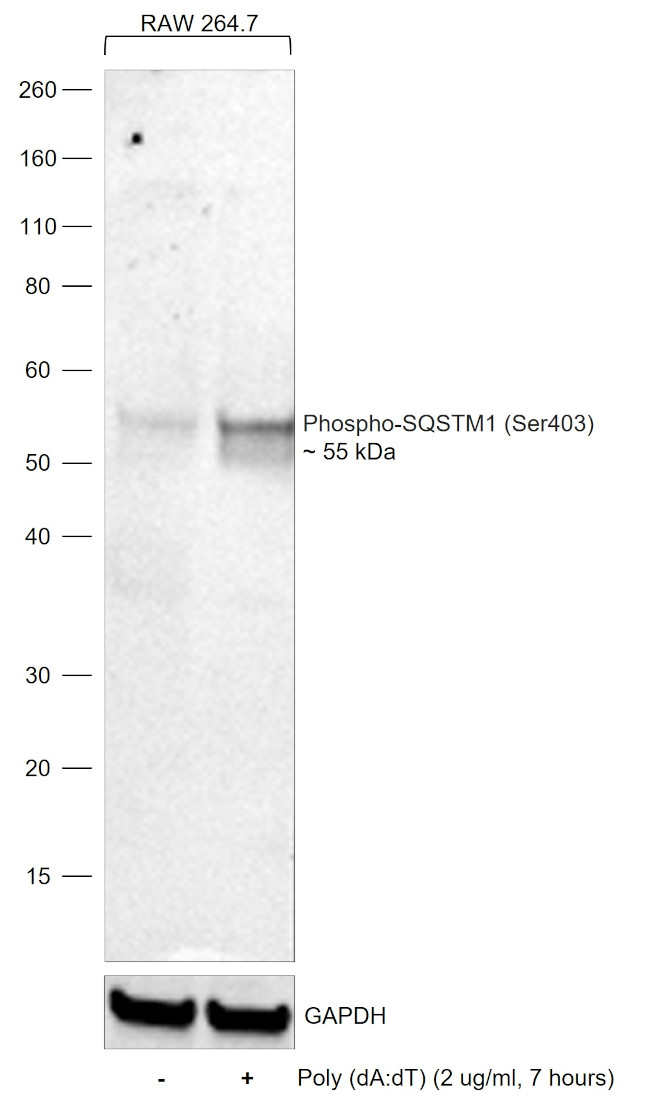 Phospho-SQSTM1 (Ser403) Antibody in Western Blot (WB)