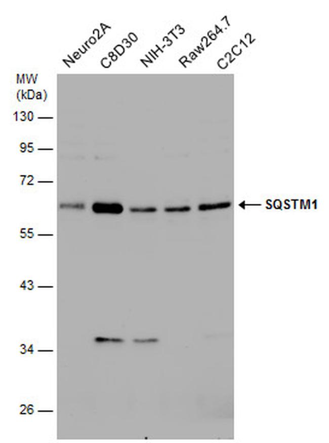 SQSTM1 Antibody in Western Blot (WB)