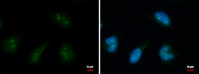 DDX18 Antibody in Immunocytochemistry (ICC/IF)