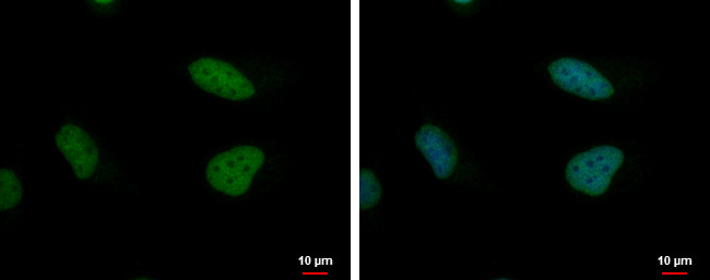 TIMELESS Antibody in Immunocytochemistry (ICC/IF)