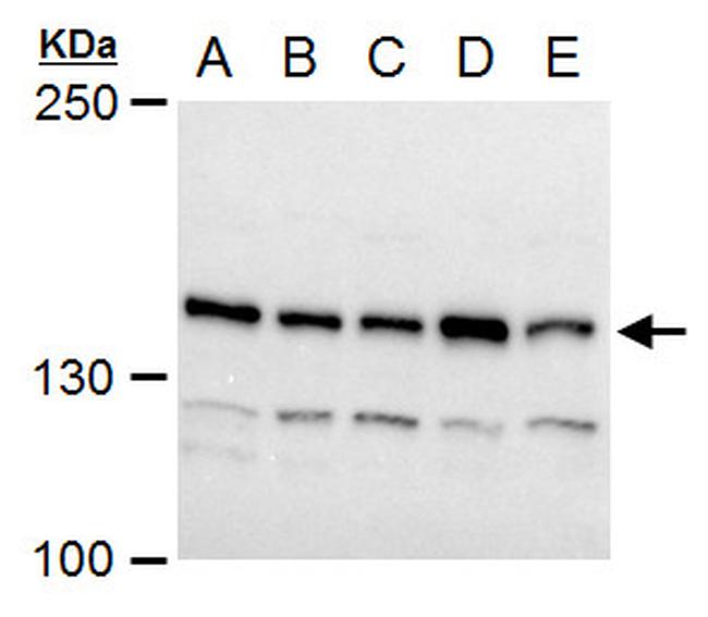 TIMELESS Antibody in Western Blot (WB)