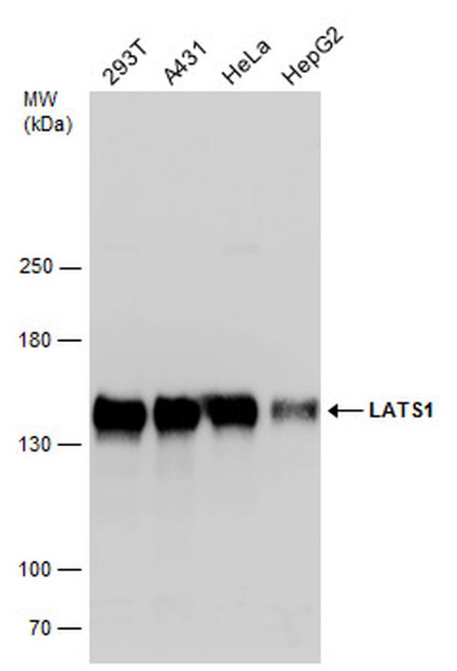 LATS1 Antibody in Western Blot (WB)