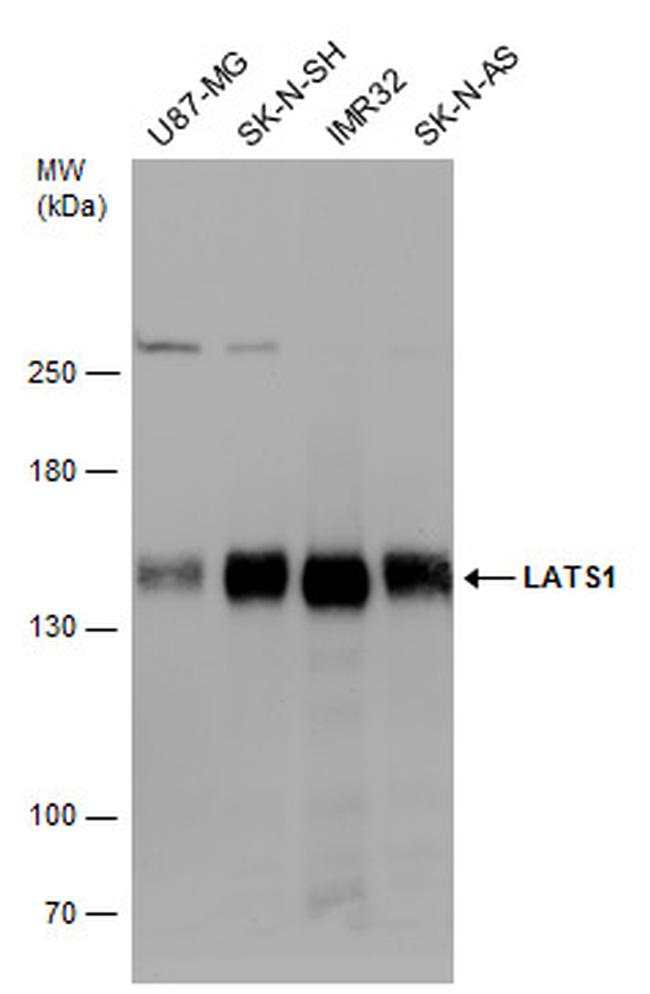 LATS1 Antibody in Western Blot (WB)