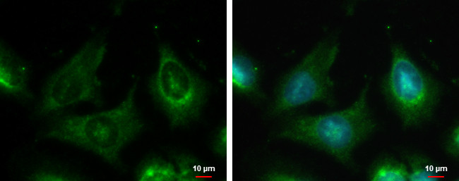 LZK Antibody in Immunocytochemistry (ICC/IF)