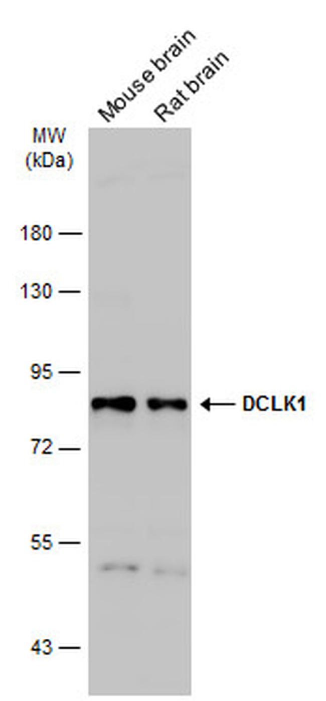 DCLK1 Antibody in Western Blot (WB)