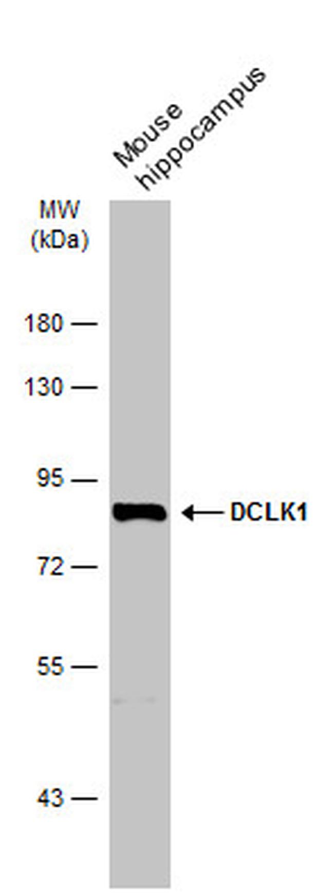 DCLK1 Antibody in Western Blot (WB)