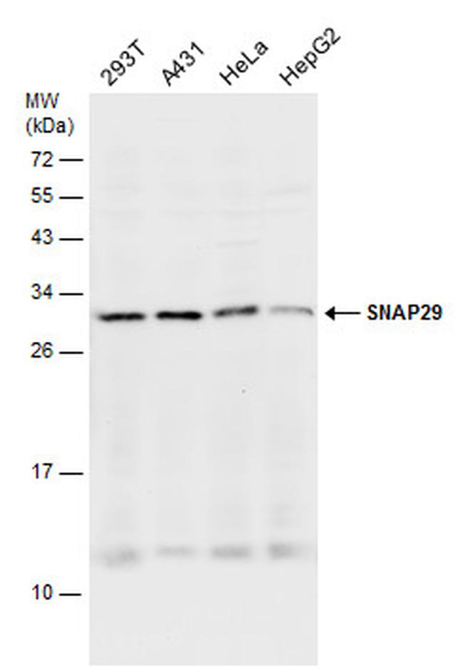 SNAP29 Antibody in Western Blot (WB)