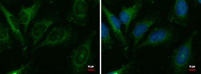 CER1 Antibody in Immunocytochemistry (ICC/IF)