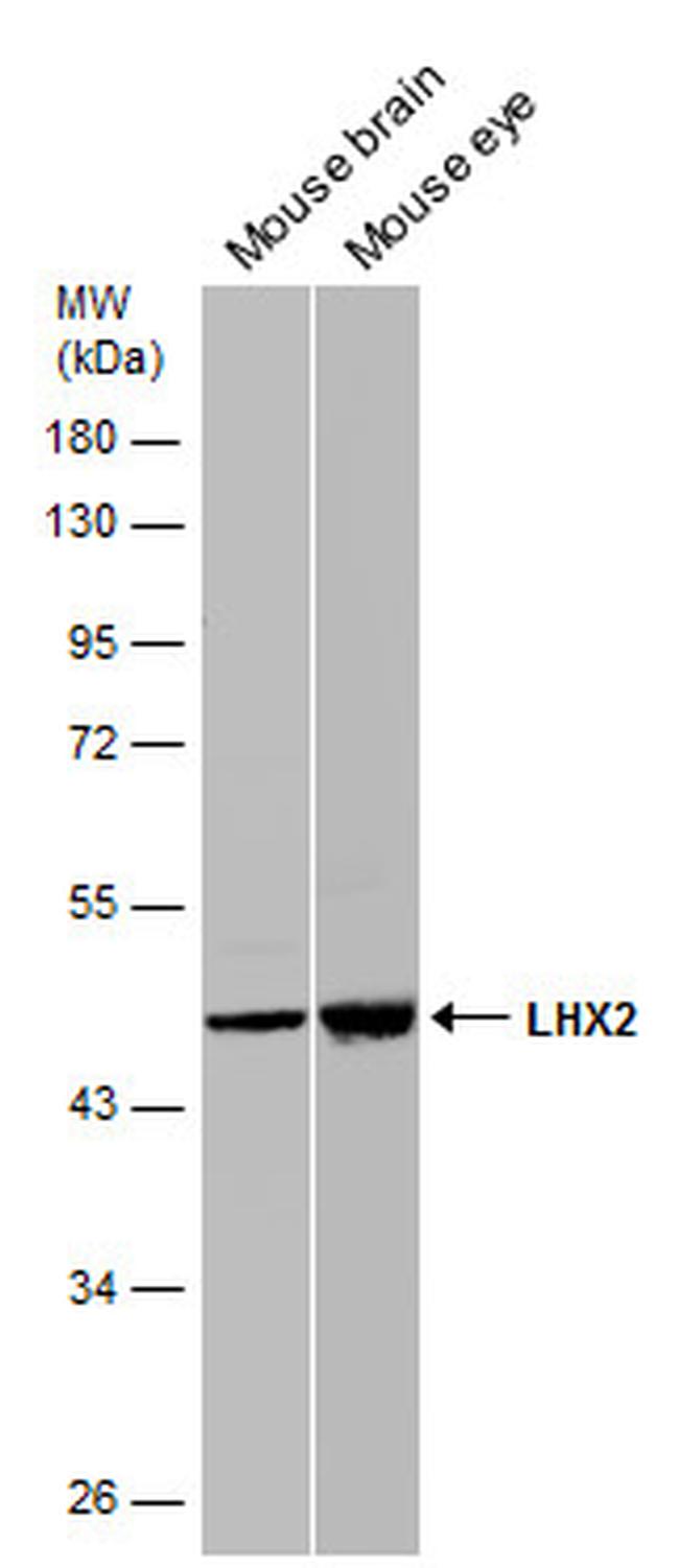 LHX2 Antibody in Western Blot (WB)