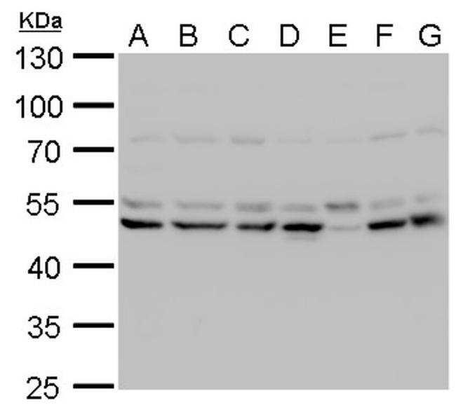 LHX2 Antibody in Western Blot (WB)