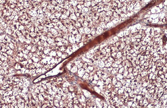 Adiponectin Antibody in Immunohistochemistry (Paraffin) (IHC (P))