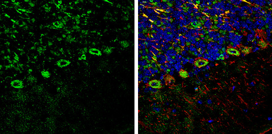 ROCK2 Antibody in Immunohistochemistry (Frozen) (IHC (F))