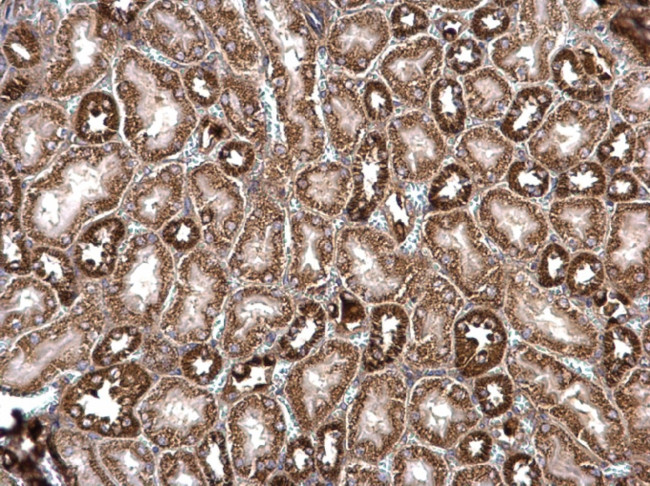 ROCK2 Antibody in Immunohistochemistry (Paraffin) (IHC (P))