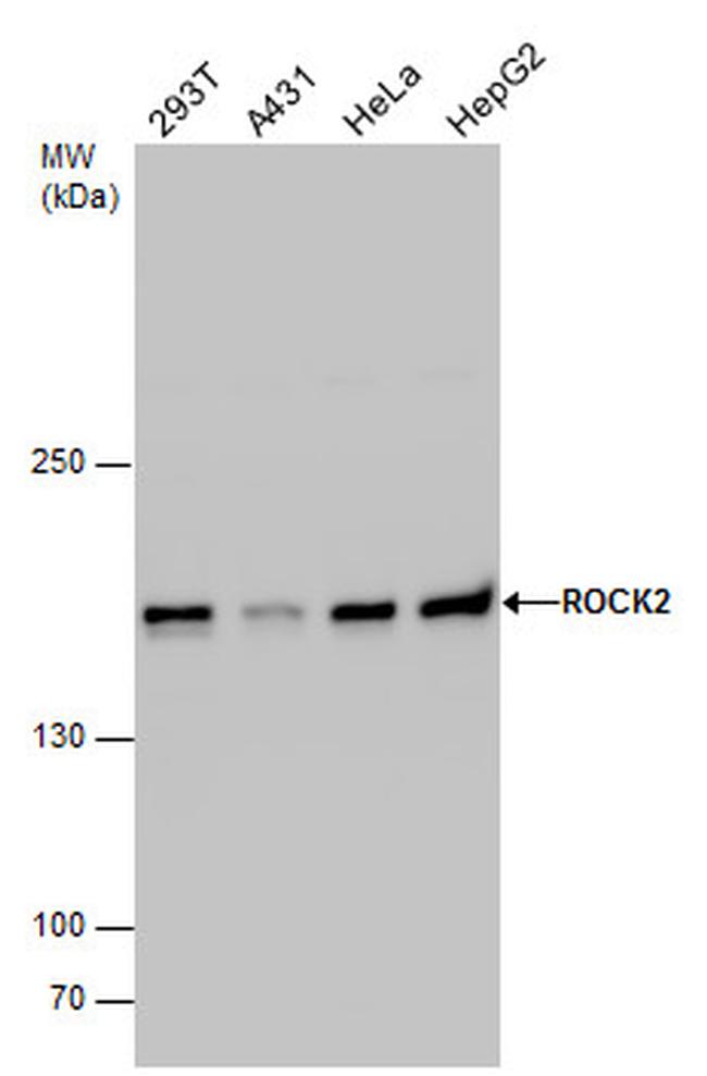 ROCK2 Antibody in Western Blot (WB)