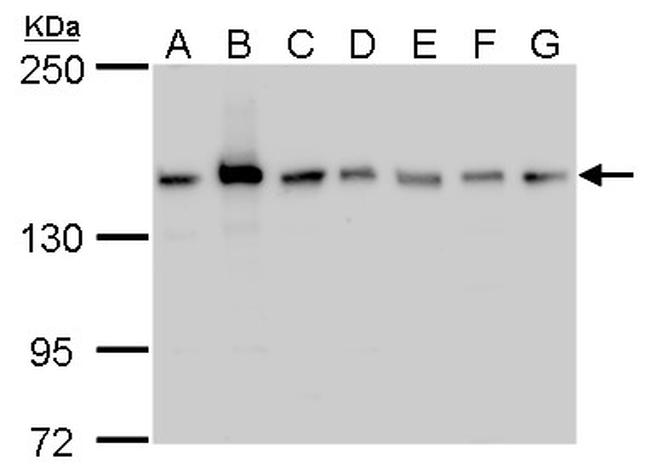 ROCK2 Antibody in Western Blot (WB)