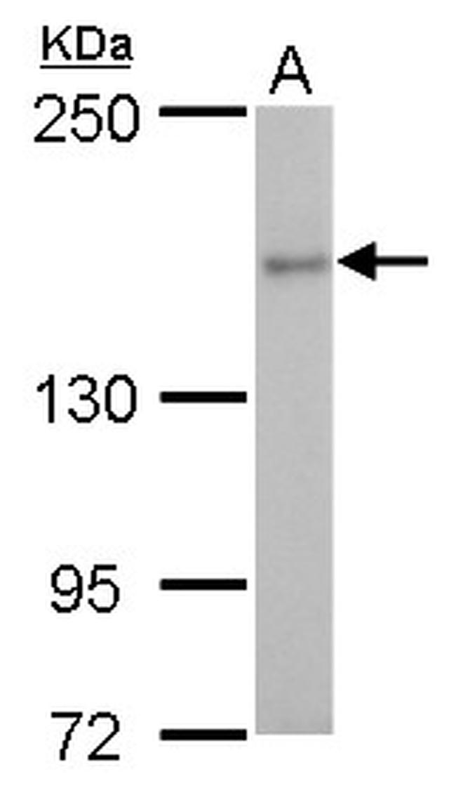 ROCK2 Antibody in Western Blot (WB)