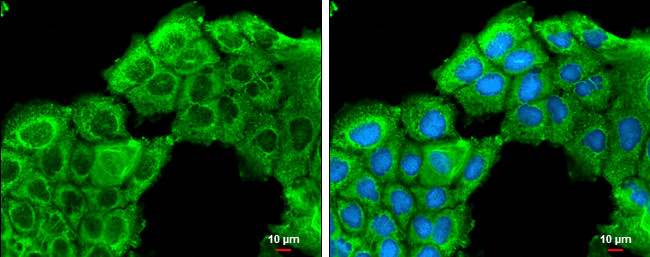 ROCK2 Antibody in Immunocytochemistry (ICC/IF)