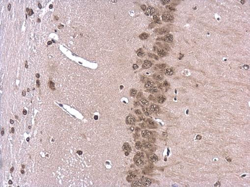 ROCK2 Antibody in Immunohistochemistry (Paraffin) (IHC (P))