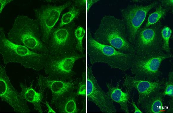 TOMM20 Antibody in Immunocytochemistry (ICC/IF)