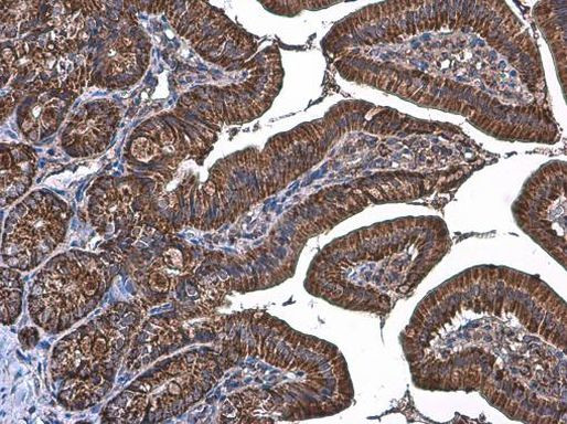 TOMM20 Antibody in Immunohistochemistry (Paraffin) (IHC (P))