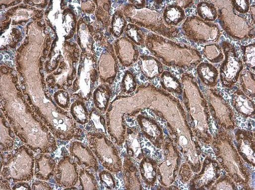 TOMM20 Antibody in Immunohistochemistry (Paraffin) (IHC (P))