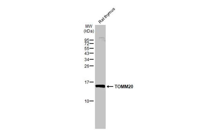 TOMM20 Antibody in Western Blot (WB)