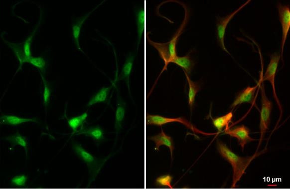 ZEB2 Antibody in Immunocytochemistry (ICC/IF)