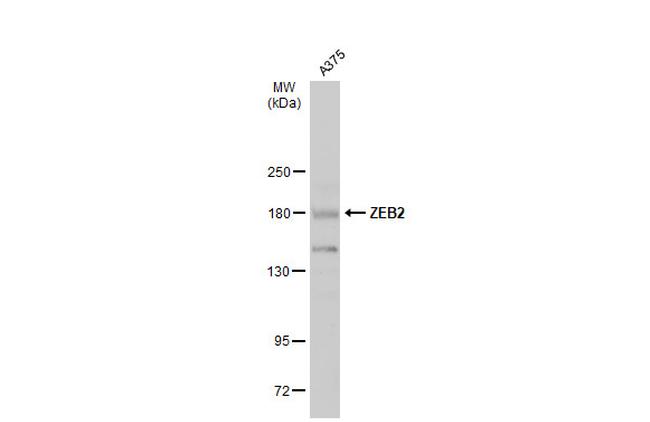 ZEB2 Antibody in Western Blot (WB)