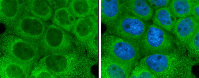 Optineurin Antibody in Immunocytochemistry (ICC/IF)