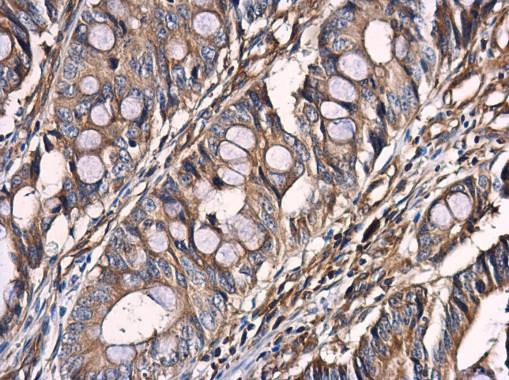 Optineurin Antibody in Immunohistochemistry (Paraffin) (IHC (P))