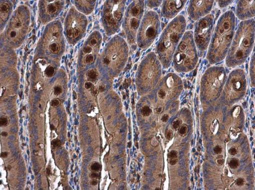 SEMA3A Antibody in Immunohistochemistry (Paraffin) (IHC (P))