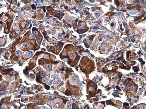 BASP1 Antibody in Immunohistochemistry (Paraffin) (IHC (P))