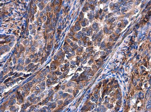 BASP1 Antibody in Immunohistochemistry (Paraffin) (IHC (P))