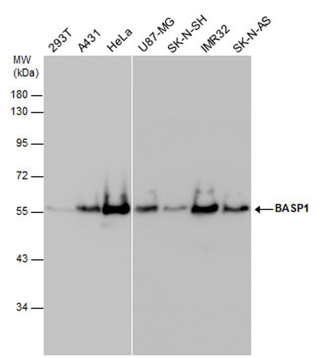 BASP1 Antibody in Western Blot (WB)