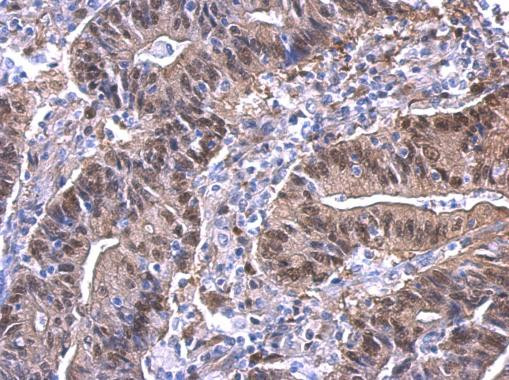 YAP1 Antibody in Immunohistochemistry (Paraffin) (IHC (P))